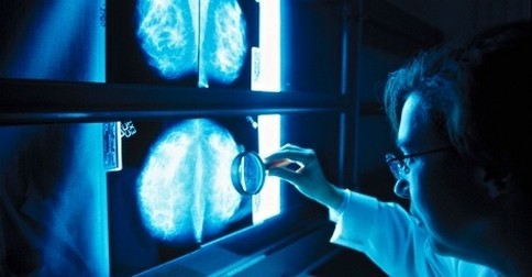 škodlivý rentgen v mamografii