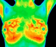 Termo scan prsu d)